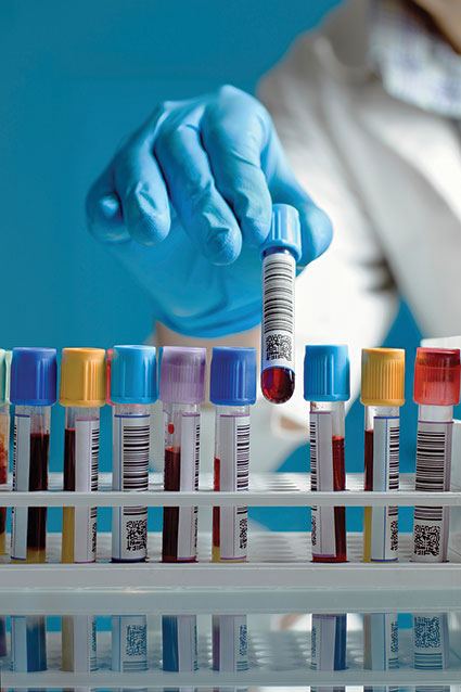 Photo shows a clinician lifting a tube of blood sample from a stand.