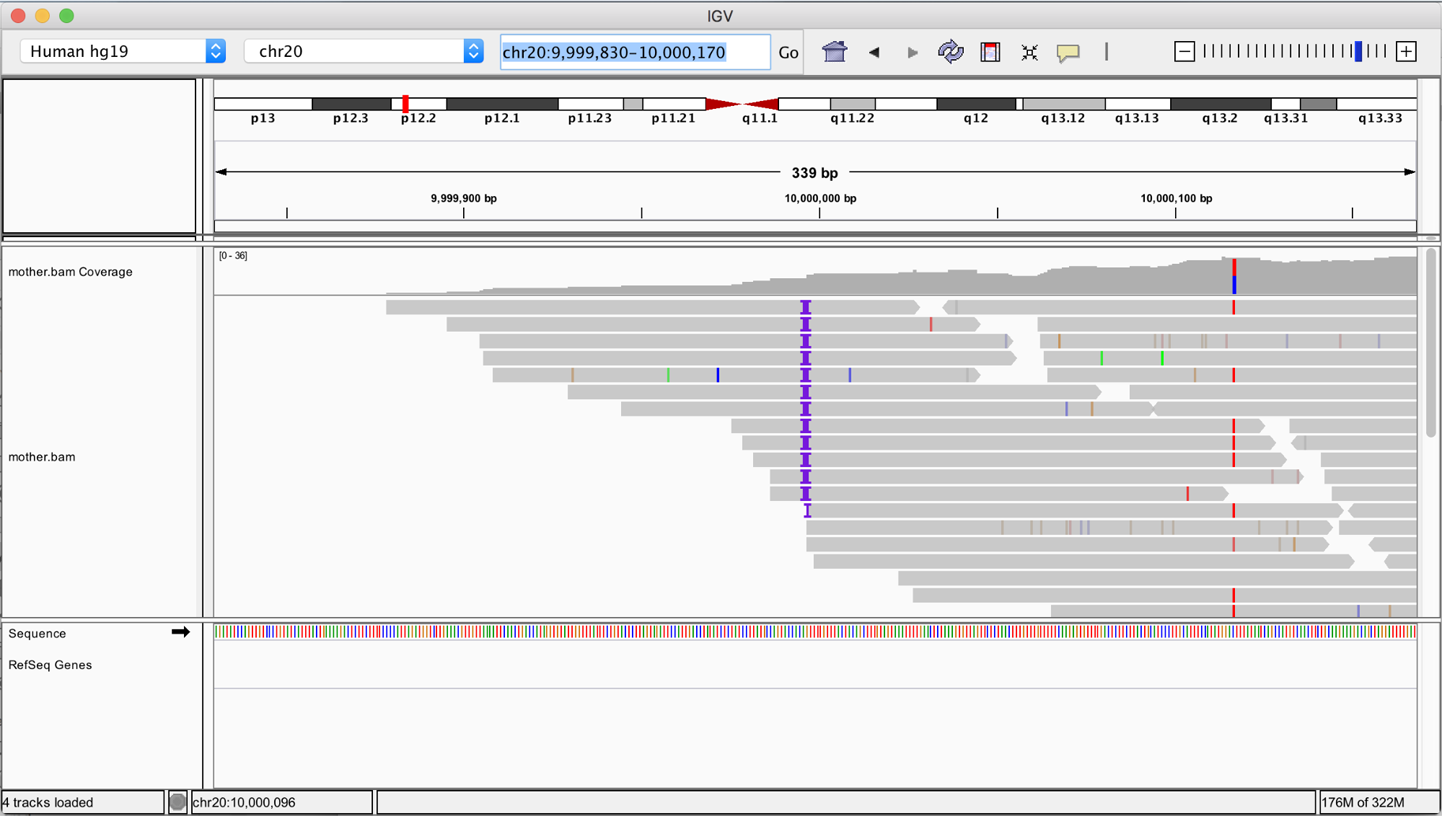 IGV view of a BAM file located in a GCS bucket.