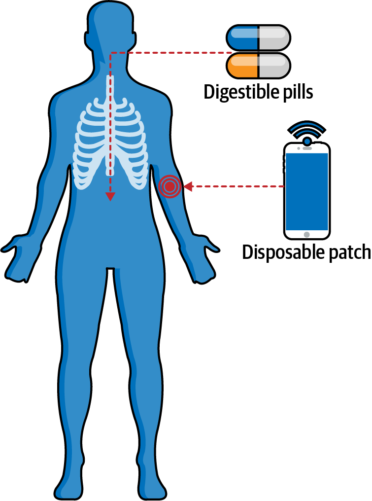 How ingestible sensors work